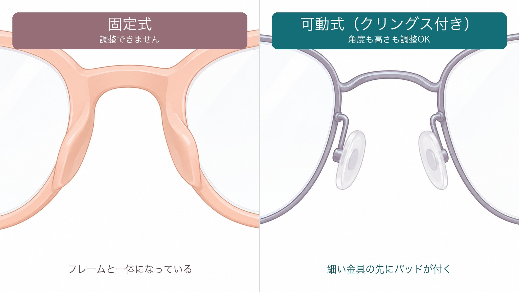 固定式と可動式の違い